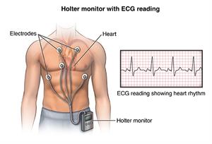 PCardio_20140402_v0_005 PCardio_20140402_v0_005
