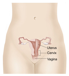 Outline of female pelvis showing uterus, cervix, and vagina.