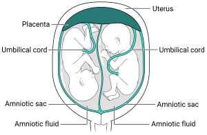 Within the uterus, there is one placenta with two amniotic sacs. Each sac has its own amniotic fluid and fetus inside.